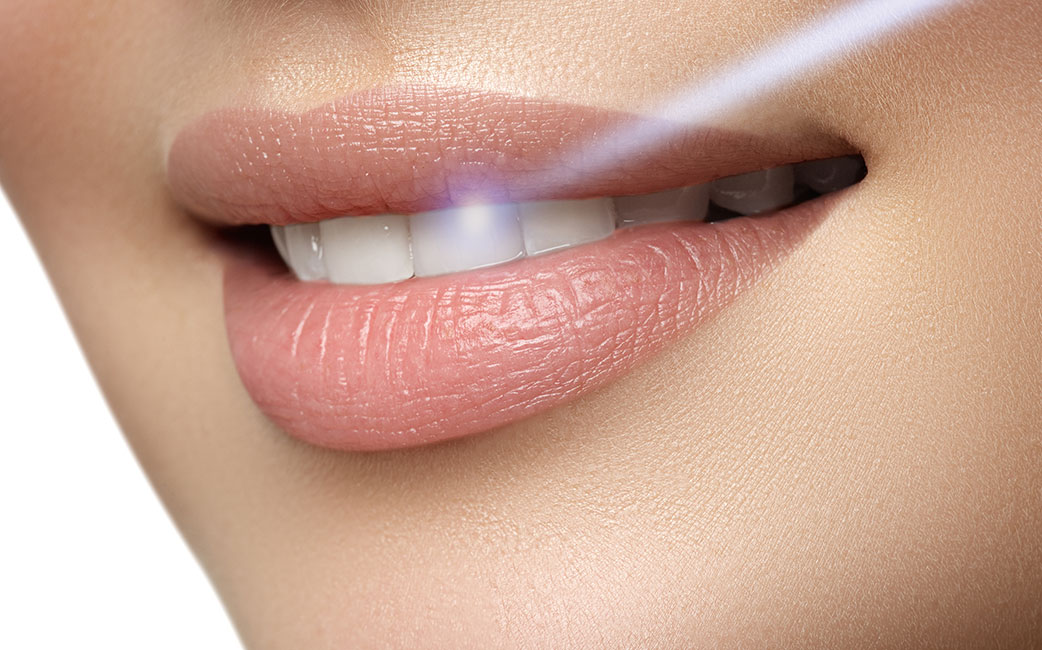 dental-lasers-santa-barbara-ca https://smilesplusmn.com/wp-content/uploads/2023/04/dental-lasers-santa-barbara-ca.jpg
