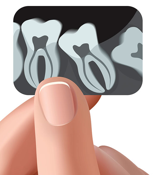 imagemaster (4) https://smilesplusmn.com/wp-content/uploads/2023/04/imagemaster-4.png