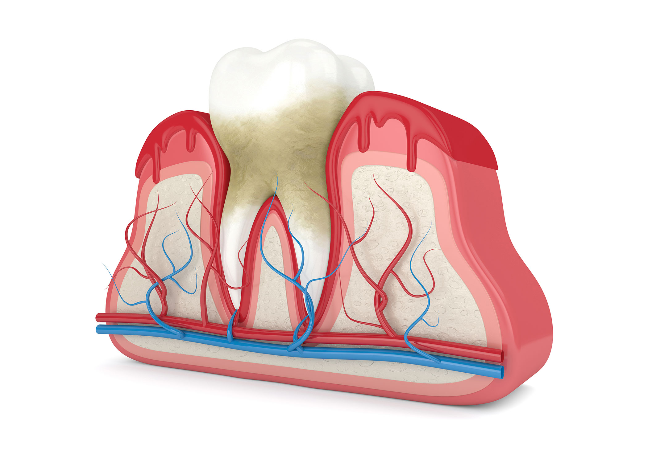periodontal-treatment-near-me-santa-barbara-ca https://smilesplusmn.com/wp-content/uploads/2023/04/periodontal-treatment-near-me-santa-barbara-ca.jpg